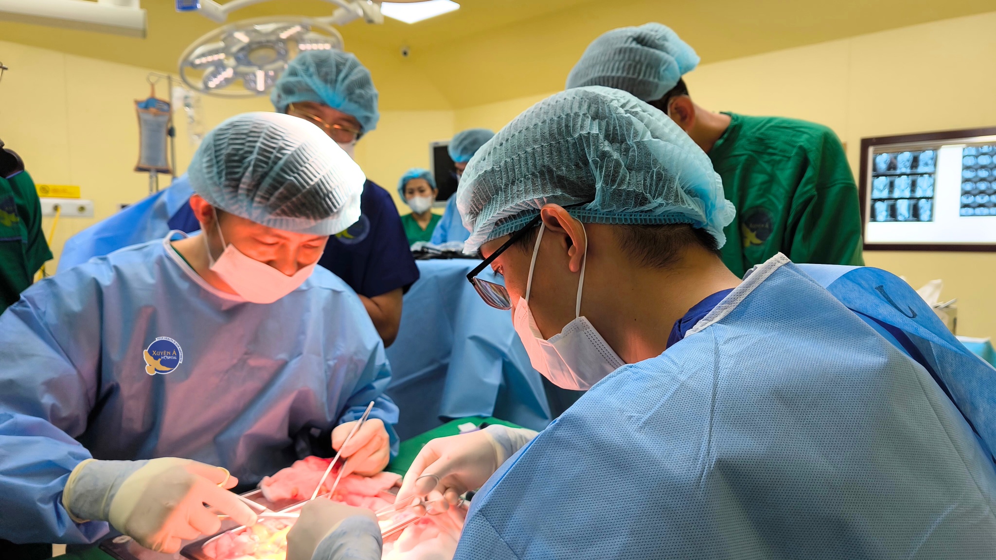 Cô gái 27 tuổi suy thận giai đoạn cuối, phải ghép thận vì 3 thói quen sai lầm mà nhiều bạn trẻ Việt mắc phải- Ảnh 2.