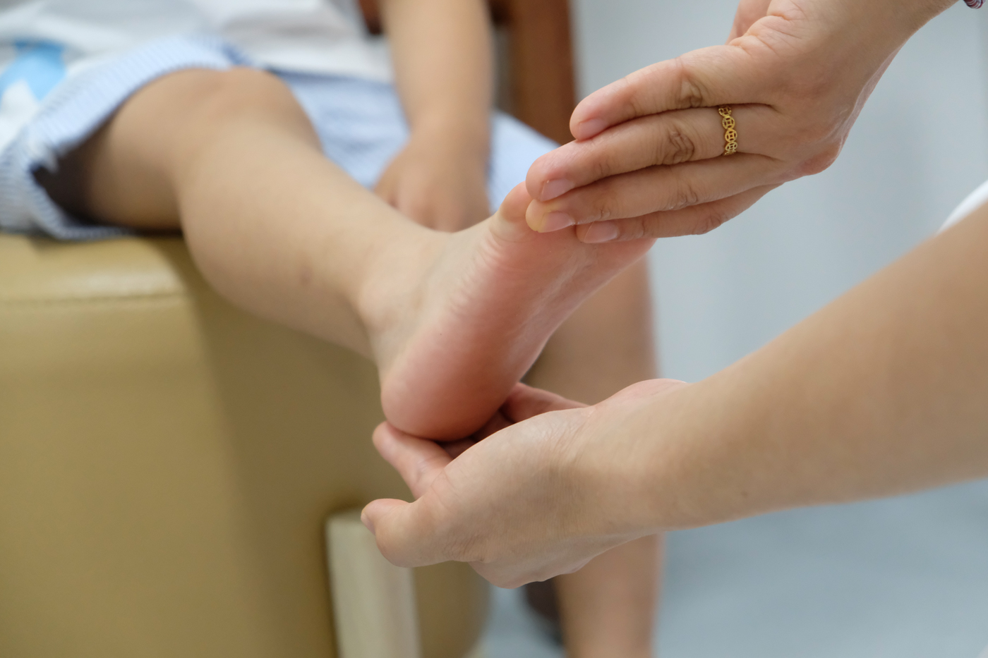 Sưng đau cổ chân phải sau khi chơi bóng rổ, tái phát nhiều lần, bé trai 11 tuổi được phát hiện có bàn chân bẹt hai bên - Ảnh 2. Sưng đau cổ chân phải sau khi chơi bóng rổ, tái phát nhiều lần, bé trai 11 tuổi được phát hiện có bàn chân bẹt hai bên - Ảnh 2.
