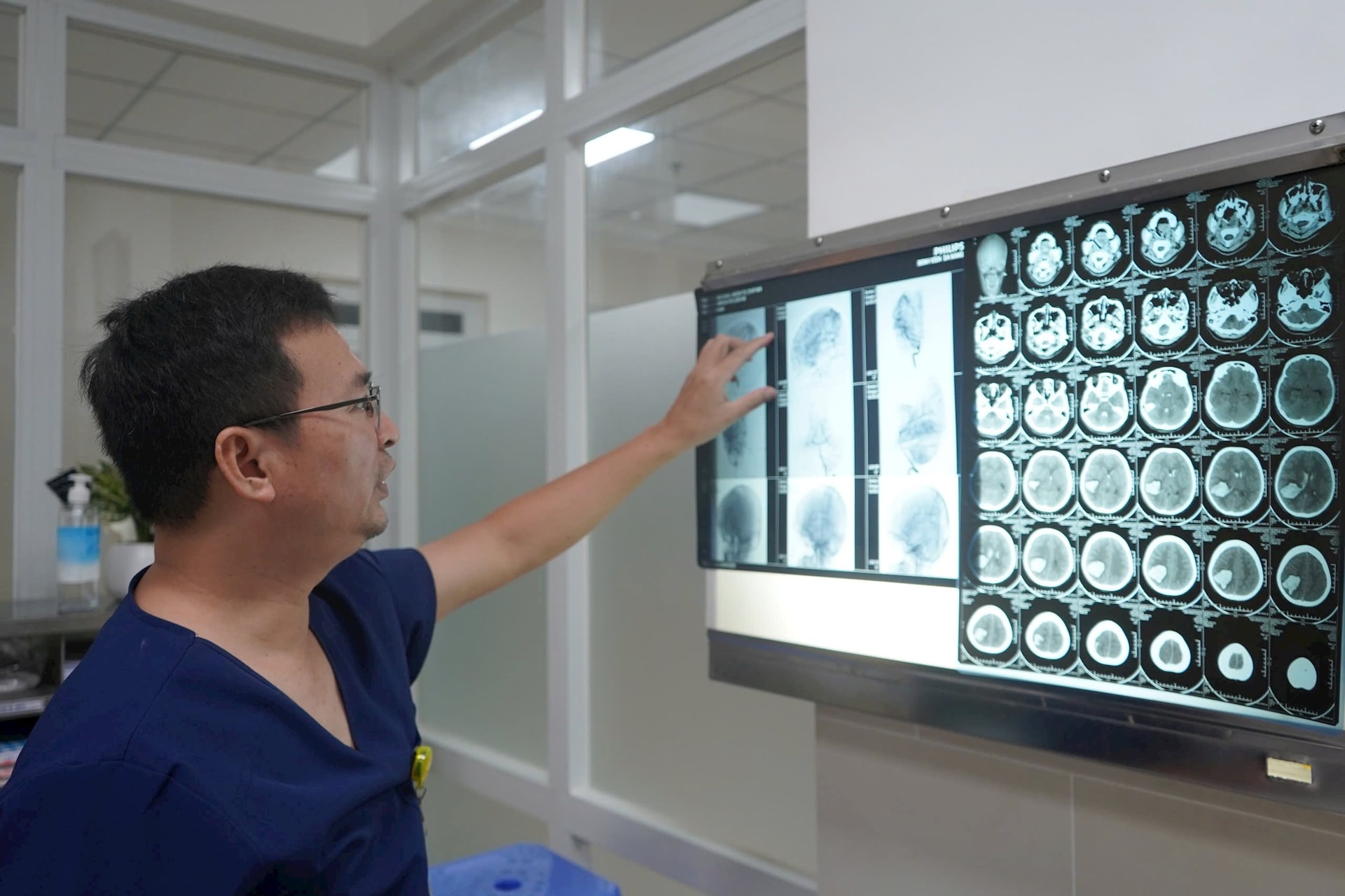 Bé 13 tuổi bất ngờ đột quỵ, hôn mê sâu khi đang tập văn nghệ ở trường- Ảnh 2.