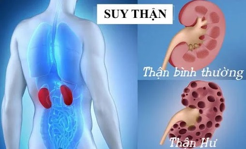 dau-hieu-suy-than-1750134773139380136527.jpg
