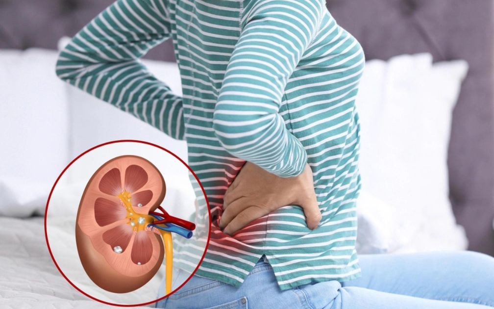 Dấu hiệu cảnh báo suy thận người Việt không nên bỏ qua
