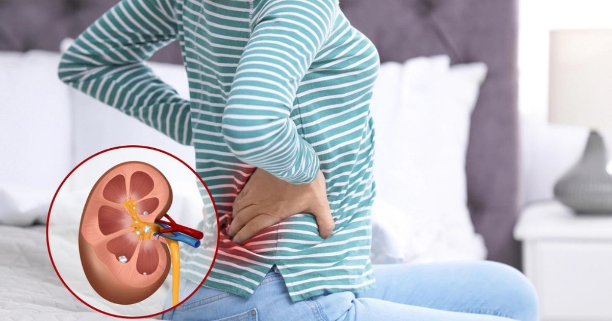 Dấu hiệu cảnh báo suy thận người Việt không nên bỏ qua - Ảnh 3.