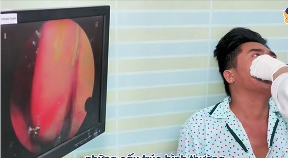 Người đàn ông 40 tuổi hứng chịu đau đầu âm ỉ suốt thời gian dài vì một sai lầm nhiều người Việt mắc phải- Ảnh 2. Người đàn ông 40 tuổi hứng chịu đau đầu âm ỉ suốt thời gian dài vì một sai lầm nhiều người Việt mắc phải- Ảnh 2.