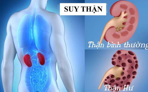 suy-than-2-1751192441860200731681-0-0-311-498-crop-1751192479180971532672.jpg