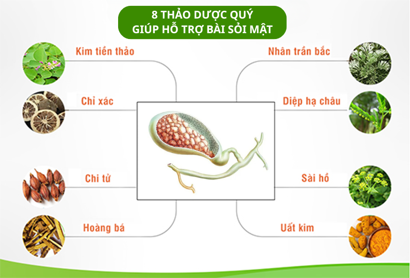 Sỏi mật - Tất cả những điều bạn cần biết- Ảnh 3. Sỏi mật - Tất cả những điều bạn cần biết- Ảnh 3.