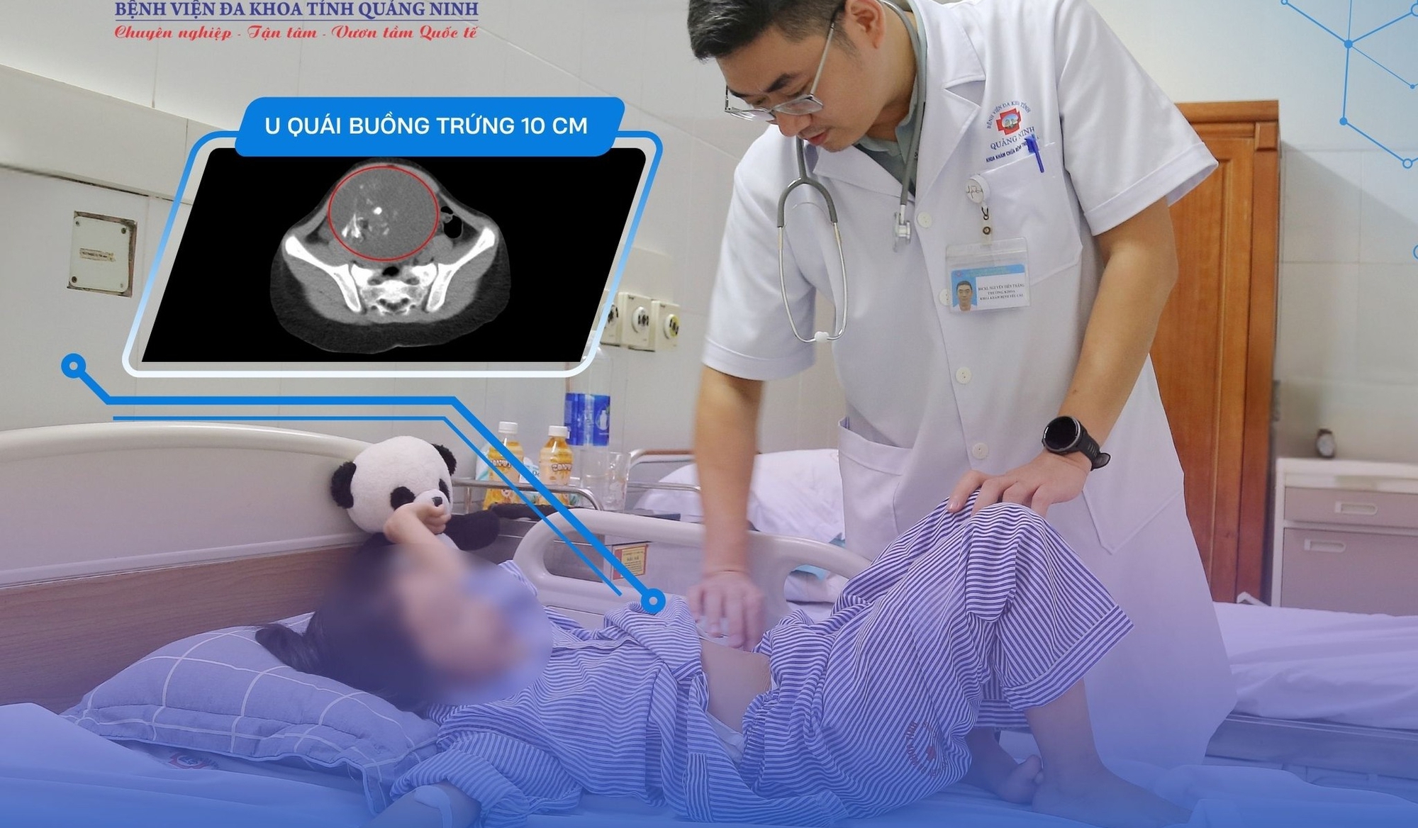 Bé 6 tuổi ở Quảng Ninh phát hiện bị u quái buồng trứng từ dấu hiệu nhiều trẻ em Việt mắc phải- Ảnh 2.