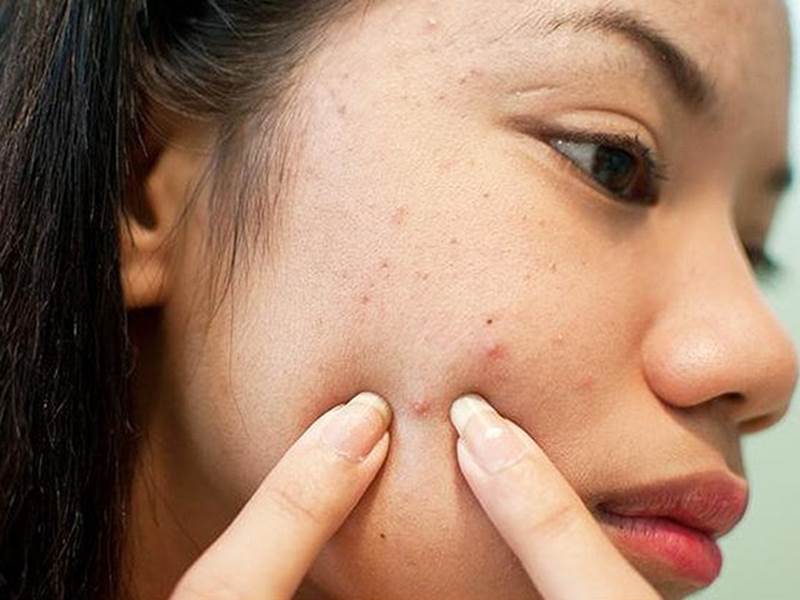 khong-nan-mun-17465916072101965953041-1749140720229-174914072050933979523.jpg