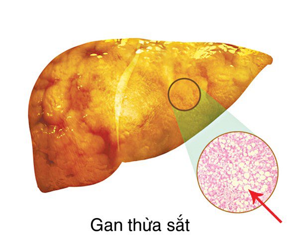 thua-sat-1749366236259859676986-1749484324168-1749484324352361559511.jpg