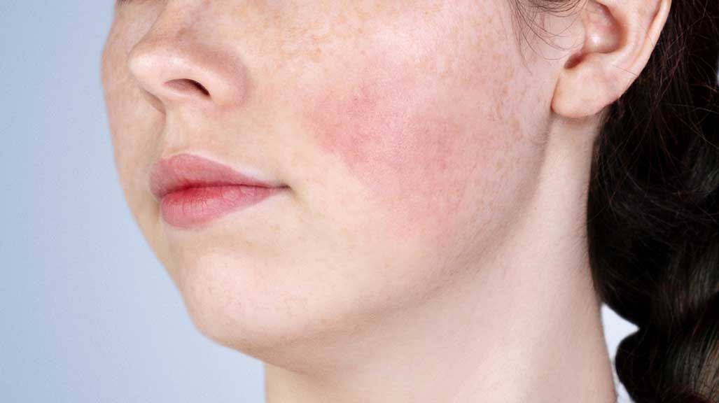retinol-3-17511950954801143668705-1751445038519-1751445038629948584440.jpg