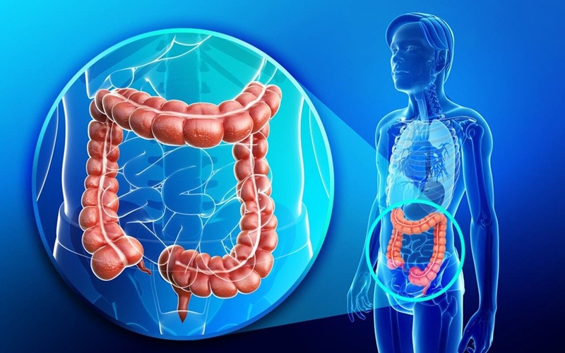 Dấu hiệu nhận biết ung thư trực tràng: Người trong gia đình có dấu hiệu này cần cảnh giác