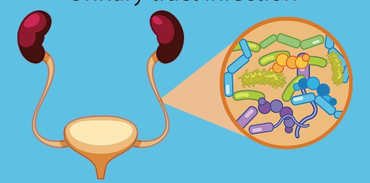 Có nên quan hệ tình dục khi bị nhiễm trùng đường tiết niệu?- Ảnh 2. Có nên quan hệ tình dục khi bị nhiễm trùng đường tiết niệu?- Ảnh 2.