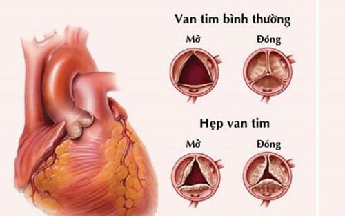 van-tim-1753507110403884557287-7-0-320-500-crop-1753507141985120935613.jpg