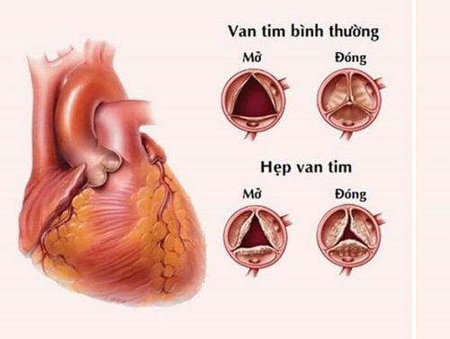 van-tim-1753507110403884557287.jpg