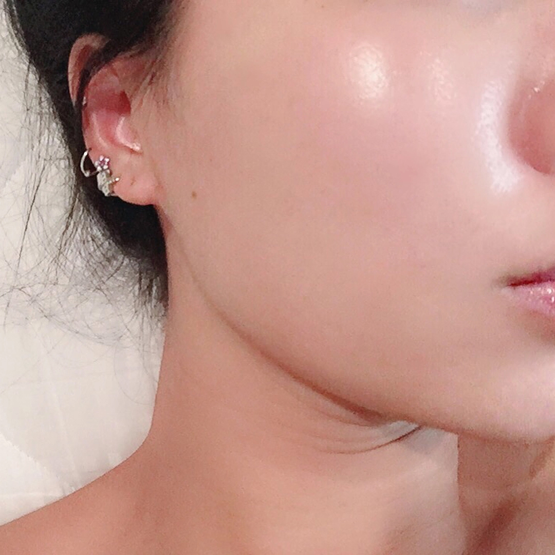 Mùa hạt sen, tôi ăn đều đặn 2 lần/tuần và kết hợp với 2 nguyên liệu: Kết quả là da mịn mướt, dưỡng ẩm tốt hơn cả đắp mặt nạ- Ảnh 4.