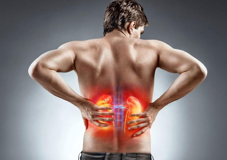 Suy thận cấp có chữa khỏi được không? 3 nhóm người có nguy cơ cao, cần cảnh giác!- Ảnh 3.