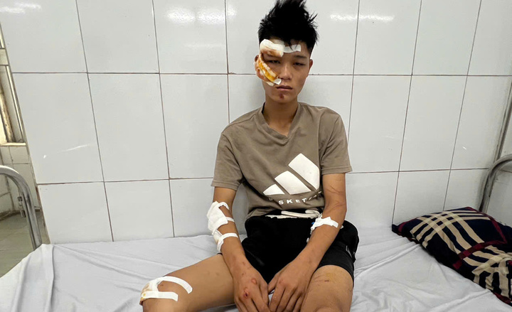 Bị điều tra tội giết người, 2 quái xế tông cảnh sát cơ động đối diện mức án nào? - Ảnh 1. Bị điều tra tội giết người, 2 quái xế tông cảnh sát cơ động đối diện mức án nào? - Ảnh 1.