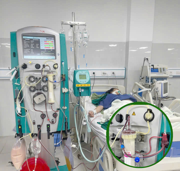 Đau bụng dữ dội khi mang thai, người phụ nữ được phát hiện mắc viêm tụy cấp - Ảnh 1. Đau bụng dữ dội khi mang thai, người phụ nữ được phát hiện mắc viêm tụy cấp - Ảnh 1.