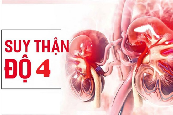 Những điều cần biết để phòng ngừa nguy cơ biến chứng suy thận độ 4 - Ảnh 1.