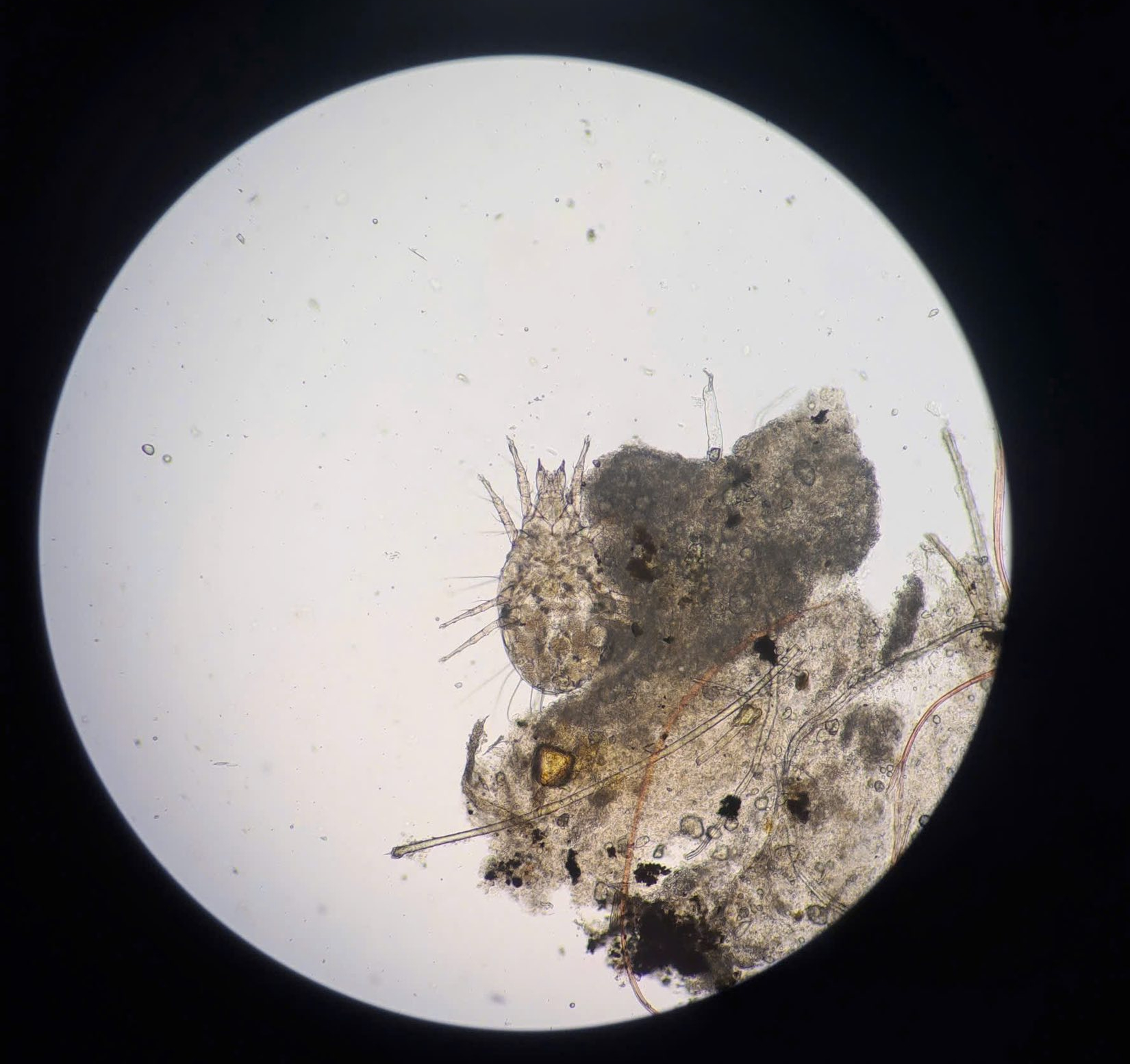 Lý do khiến người phụ nữ bị ngứa mi mắt dai dẳng suốt 3 năm - Ảnh 2.