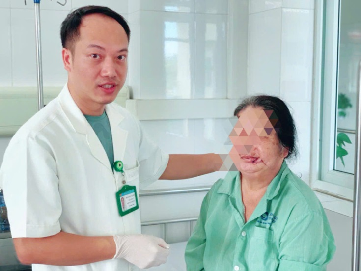 Người phụ nữ bị ung thư da từ dấu hiệu nhiều người Việt mắc phải - Ảnh 2.