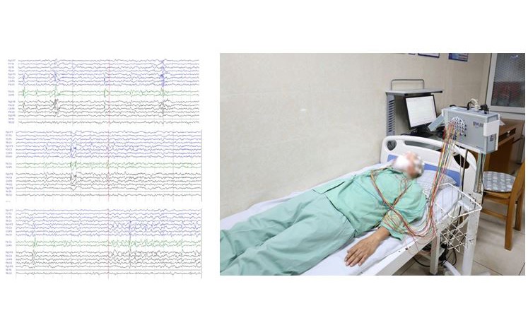 Người đàn ông ở Hà Nội bị thủng ruột từ dấu hiệu nhiều người Việt bỏ qua - Ảnh 2.