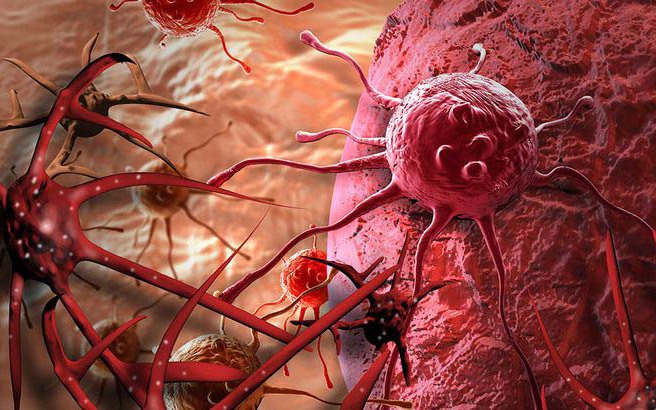 "Thủ phạm" gây ung thư cổ tử cung, chị em nhất định phải biết để phòng tránh