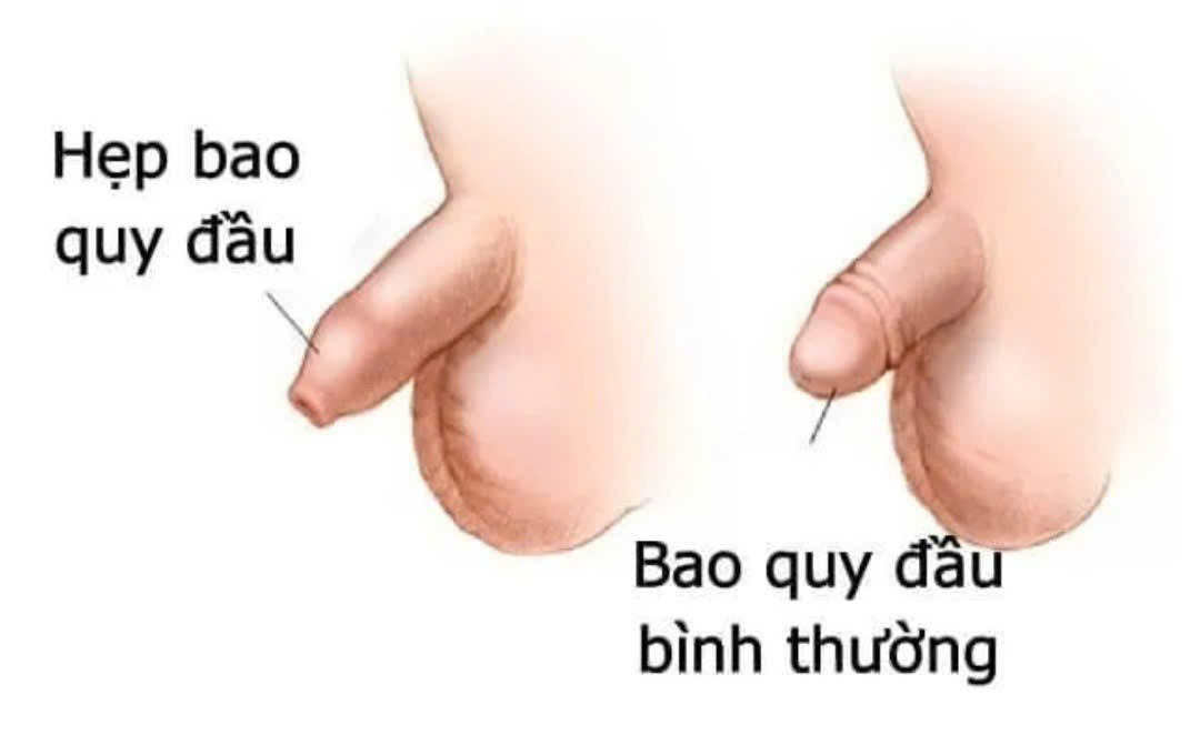 hep-bao-quy-dau-1757320858822299583767-1758762494899-1758762495523102146368.jpg