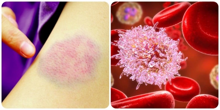 Nam diễn viên 34 đang khỏe mạnh bất ngờ tiết lộ mắc ung thư máu: Tâm sự đầy xúc động! - Ảnh 3.