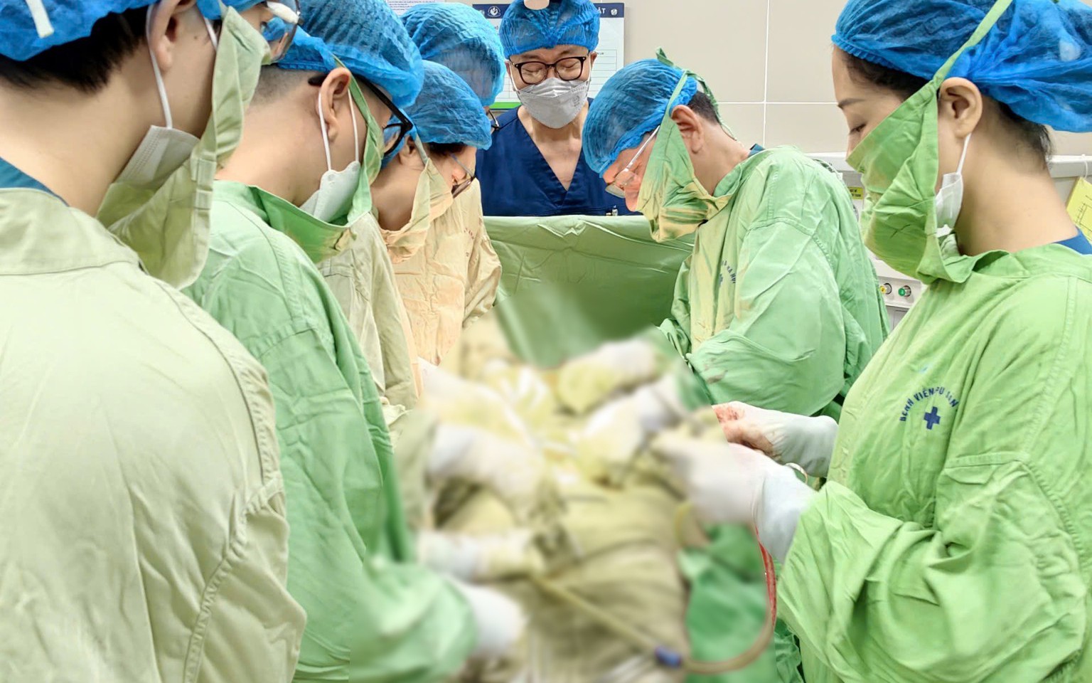 Đi khám sức khỏe định kỳ, cô gái 25 tuổi vô tình phát hiện khối u to vùng đầu tụy - Ảnh 3.