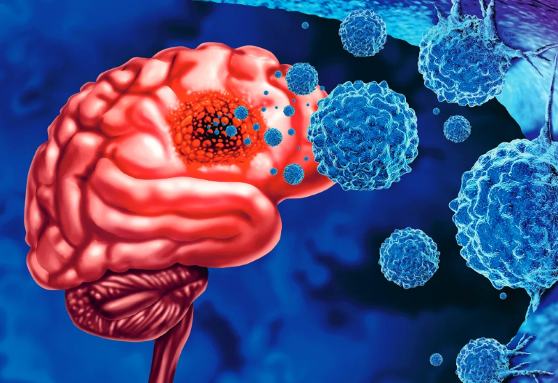 Đi khám vì đau đầu, thanh niên 19 tuổi ở Phú Thọ phát hiện bệnh nguy hiểm hiếm gặp - Ảnh 1.