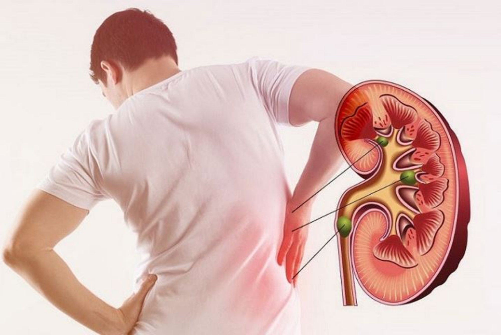 Thanh niên 26 tuổi suy thận phải chạy thận: "Tôi không tin mình bị suy thận vì vẫn thấy cơ thể bình thường' - Ảnh 3. Thanh niên 26 tuổi suy thận phải chạy thận: "Tôi không tin mình bị suy thận vì vẫn thấy cơ thể bình thường' - Ảnh 3.