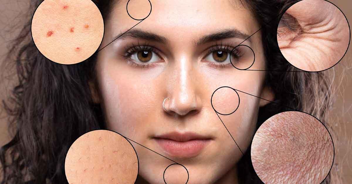 70% ca ung thư hắc tố bắt nguồn từ những thói quen tưởng như vô hại này - Ảnh 2.