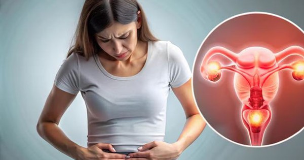 Thai phụ 33 tuổi xoắn buồng trứng t&aacute;i diễn sau 4 ng&agrave;y: Cảnh b&aacute;o dấu hiệu dễ nhầm với chuyển dạ - Ảnh 2.