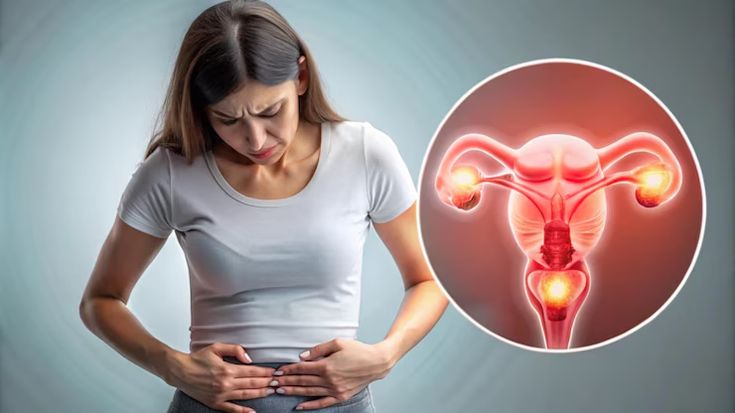 Đau bụng dưới cảnh gi&aacute;c với xoắn buồng trứng- Ảnh 1.