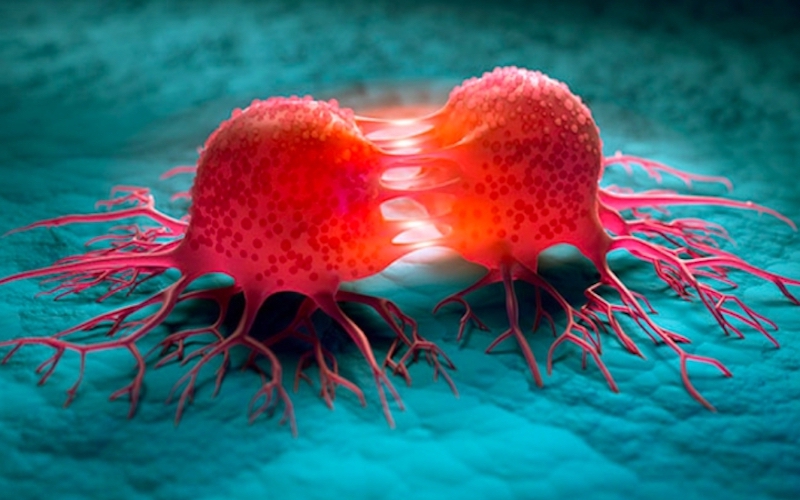 Tế b&agrave;o ung thư h&igrave;nh th&agrave;nh c&oacute; đặc điểm g&igrave;? Người Việt cần hiểu đ&uacute;ng để ngăn ngừa bệnh