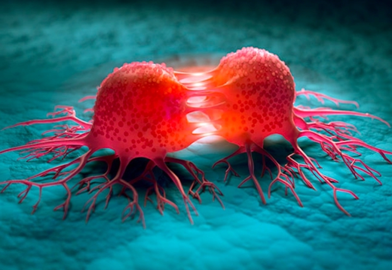 Đặc điểm của tế bào ung thư, người Việt cần hiểu đúng để ngăn ngừa bệnh - Ảnh 2. Đặc điểm của tế bào ung thư, người Việt cần hiểu đúng để ngăn ngừa bệnh - Ảnh 2.