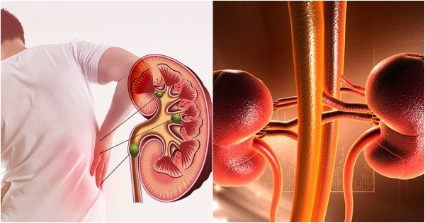 Suy thận tiến triển rất nhanh: 4 dấu hiệu cảnh b&aacute;o cho người tiểu đường - Ảnh 2.