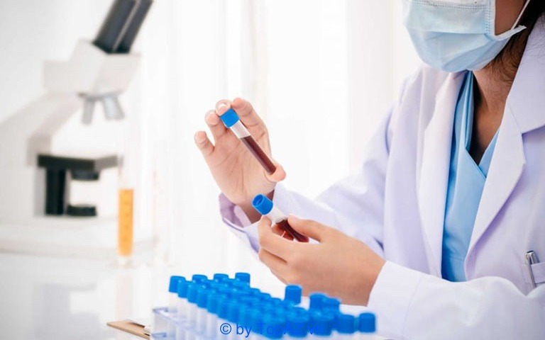 X&eacute;t nghiệm ADN khiến chồng nghi vợ ngoại t&igrave;nh, y học lại chứng minh người vợ v&ocirc; tội