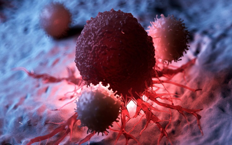 Nguy&ecirc;n nh&acirc;n khiến tế b&agrave;o ung thư h&igrave;nh th&agrave;nh v&agrave; ph&aacute;t triển, người Việt cần biết để tr&aacute;nh