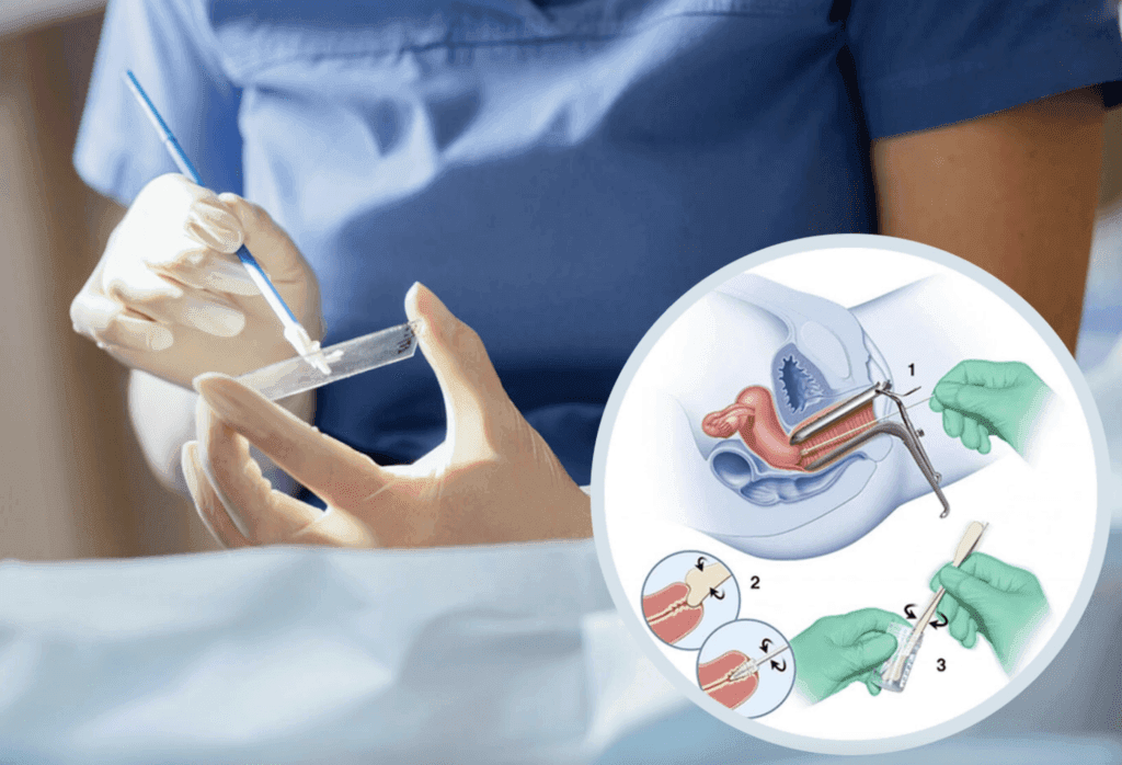 Khi n&agrave;o n&ecirc;n l&agrave;m x&eacute;t nghiệm Pap để s&agrave;ng lọc ung thư cổ tử cung?- Ảnh 1.
