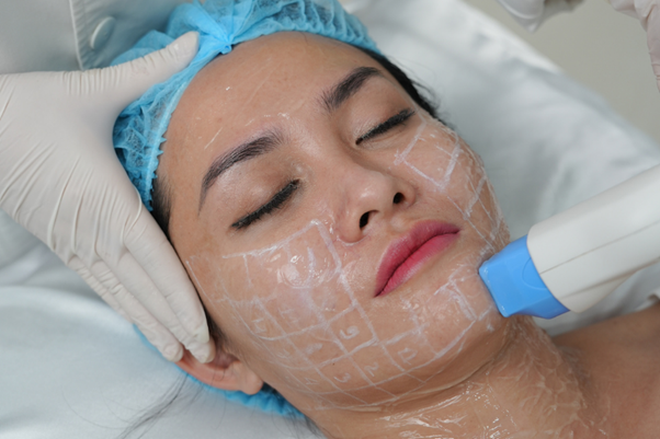 Top 7 công nghệ trẻ hóa da tiên tiến hiện nay - Ảnh 3. Top 7 công nghệ trẻ hóa da tiên tiến hiện nay - Ảnh 3.