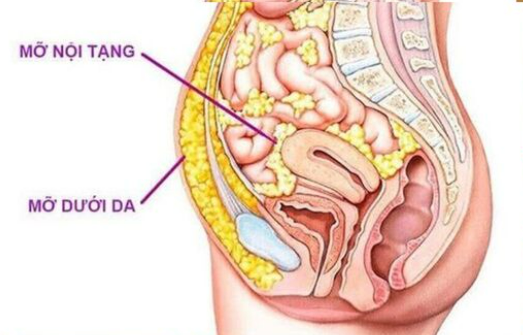 6 điều bạn n&ecirc;n l&agrave;m để giảm mỡ nội tạng hiệu quả, bền vững- Ảnh 1.