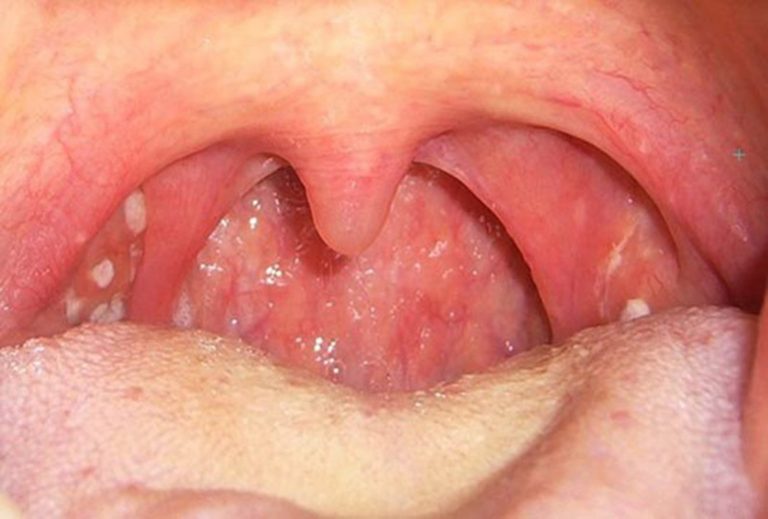 5 vị trí tế bào ung thư dễ 'đột nhập', người Việt nên hiểu đúng để ngừa bệnh từ sớm - Ảnh 2. 5 vị trí tế bào ung thư dễ 'đột nhập', người Việt nên hiểu đúng để ngừa bệnh từ sớm - Ảnh 2.