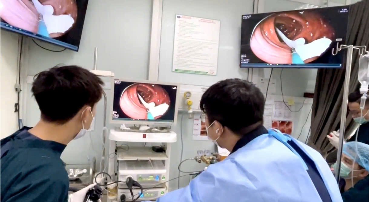 Bụng sôi, sụt cân bất thường, người đàn ông 35 tuổi phát hiện sán dây lợn dài hơn 80cm trong đại tràng - Ảnh 1.