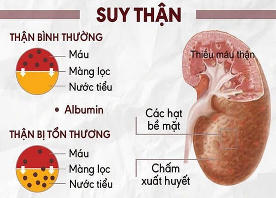 suy-than-dien-ra-nhu-the-nao-1767857855000991887776.jpg