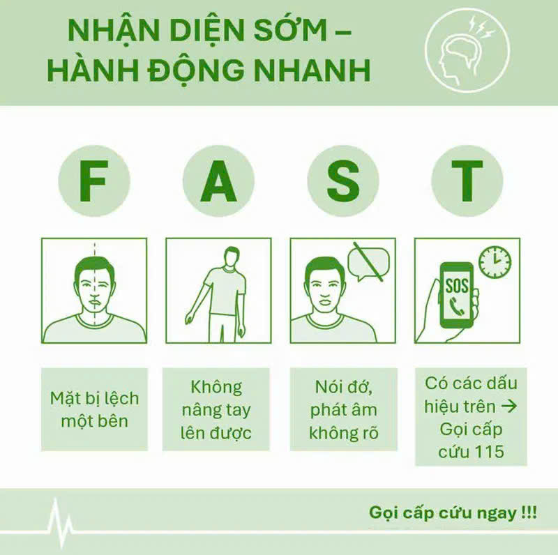 Sơ cứu đột quỵ: Một sai lầm nhỏ để lại di chứng đ&aacute;ng tiếc suốt đời - Ảnh 2.