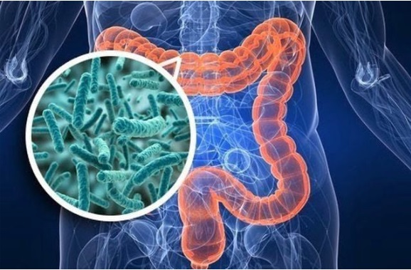 Kh&ocirc;ng c&oacute; triệu chứng ti&ecirc;u h&oacute;a điển h&igrave;nh, nam kỹ sư bất ngờ ph&aacute;t hiện ung thư đại trực tr&agrave;ng từ dấu hiệu nhiều người Việt mắc phải - Ảnh 1.