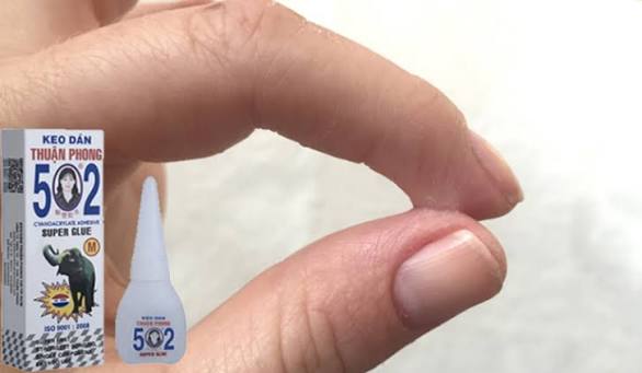 Mẹo tẩy keo 502 khi bị d&iacute;nh v&agrave;o người hoặc quần &aacute;o - Ảnh 2.