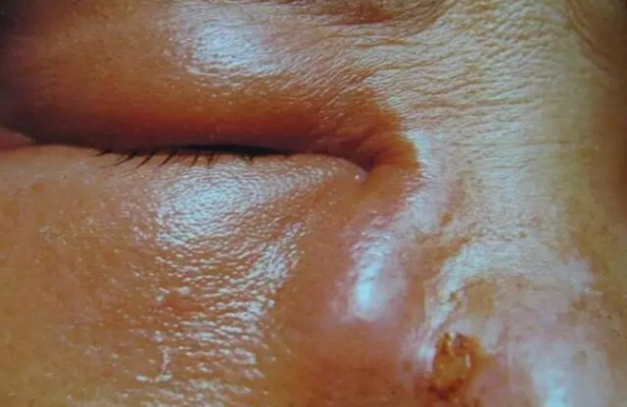 S&aacute;ng ngủ dậy nước mắt &ldquo;d&iacute;nh như keo&rdquo;, người phụ nữ đi kh&aacute;m ph&aacute;t hiện điều bất ngờ - Ảnh 1.