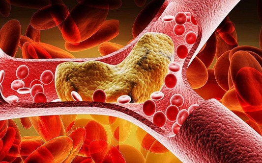 Người Cholesterol Cao Ăn Tết Thế Nào Để Không Tăng Mỡ Máu: Chuyên Gia Chỉ Rõ Nguyên Tắc Lựa Chọn Thực Phẩm